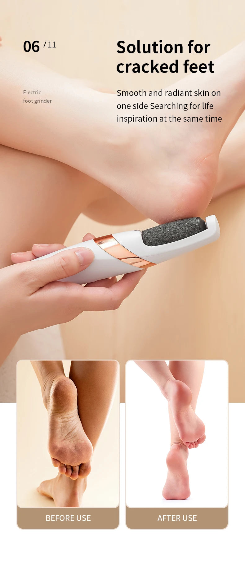 HOMEFISH Electric Foot Grinder Automatic Foot Callus Rubbing Pedicure Dead Skin Callus Remover for  Foot Beauty Machine